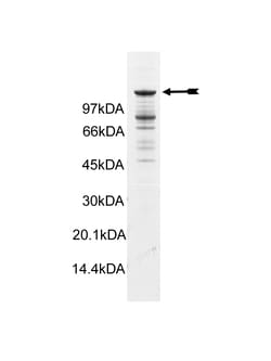 Eurofins DiscoverX Abl (Q252H) Protein, Active 10 &mu;g | Buy Online | Eurofins DiscoverX | Fisher Scientific